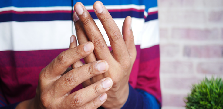 psoriasis