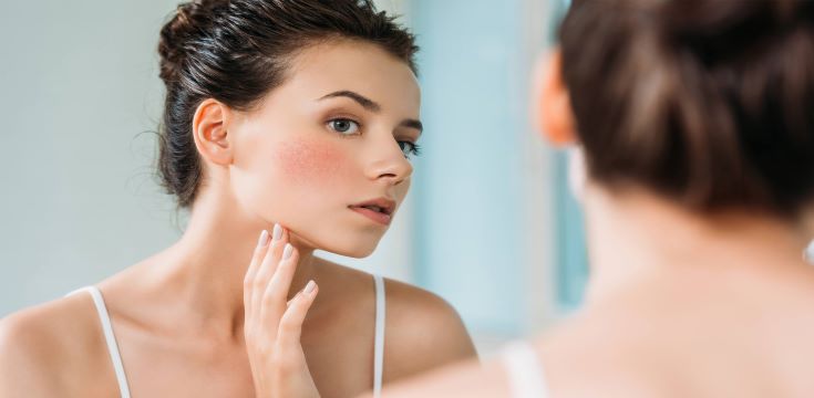 main_woman_w_flushed_skin