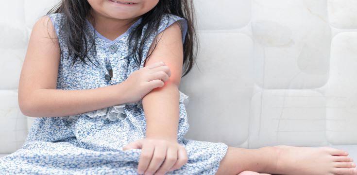 Skin-rash-child