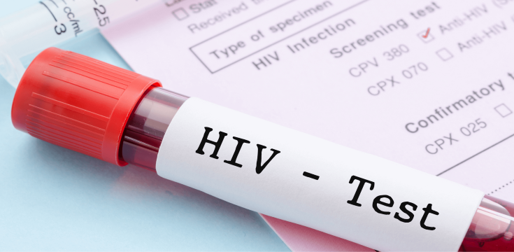 HIV