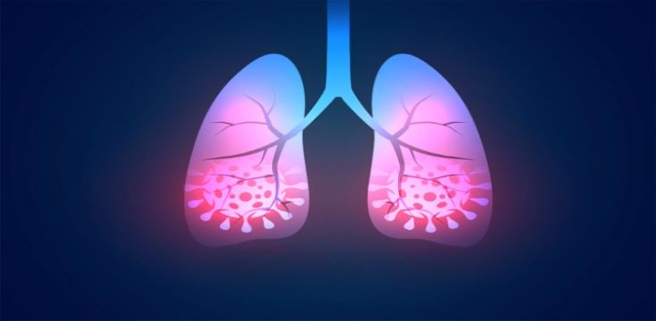 seo-blog-covid-and-lungs