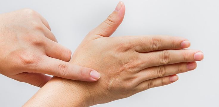 Hand_scar