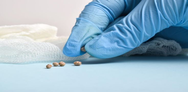 Gallstones
