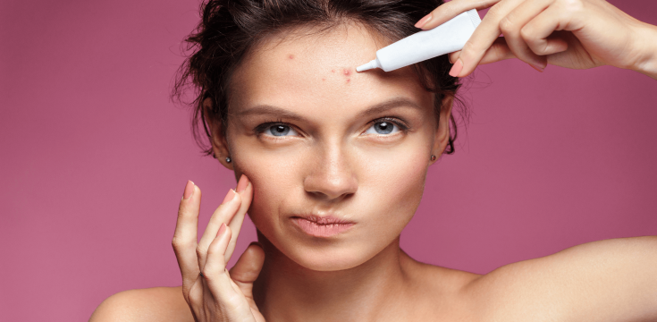 Forehead acne