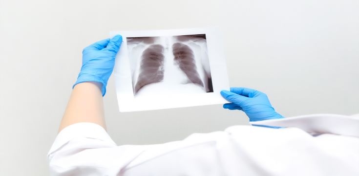 doctor-diagnosing-patients-health-asthma-lung-disease-covid-19-coronavirus-illness-with-radiologic[10303]