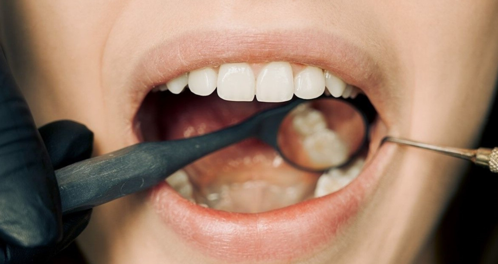 oral-health-smoking-effects