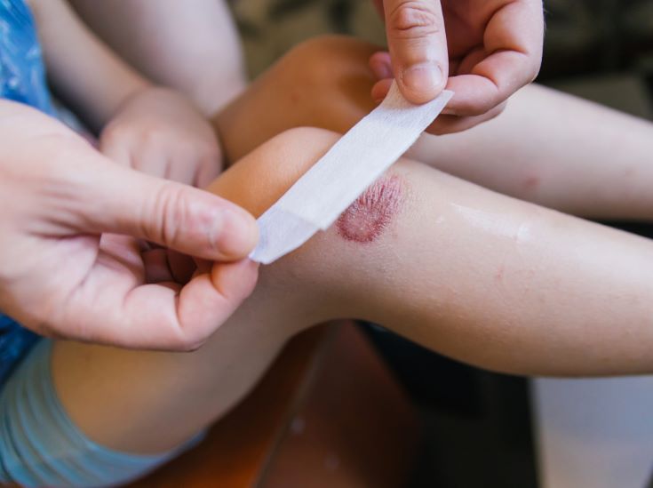man-s-hand-sticks-band-aid-damaged-skin-child-s-leg-abrasion-scratch-knee-first-medical-care